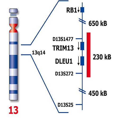 IVD DLEU1/TP53 製品画像 Back View L